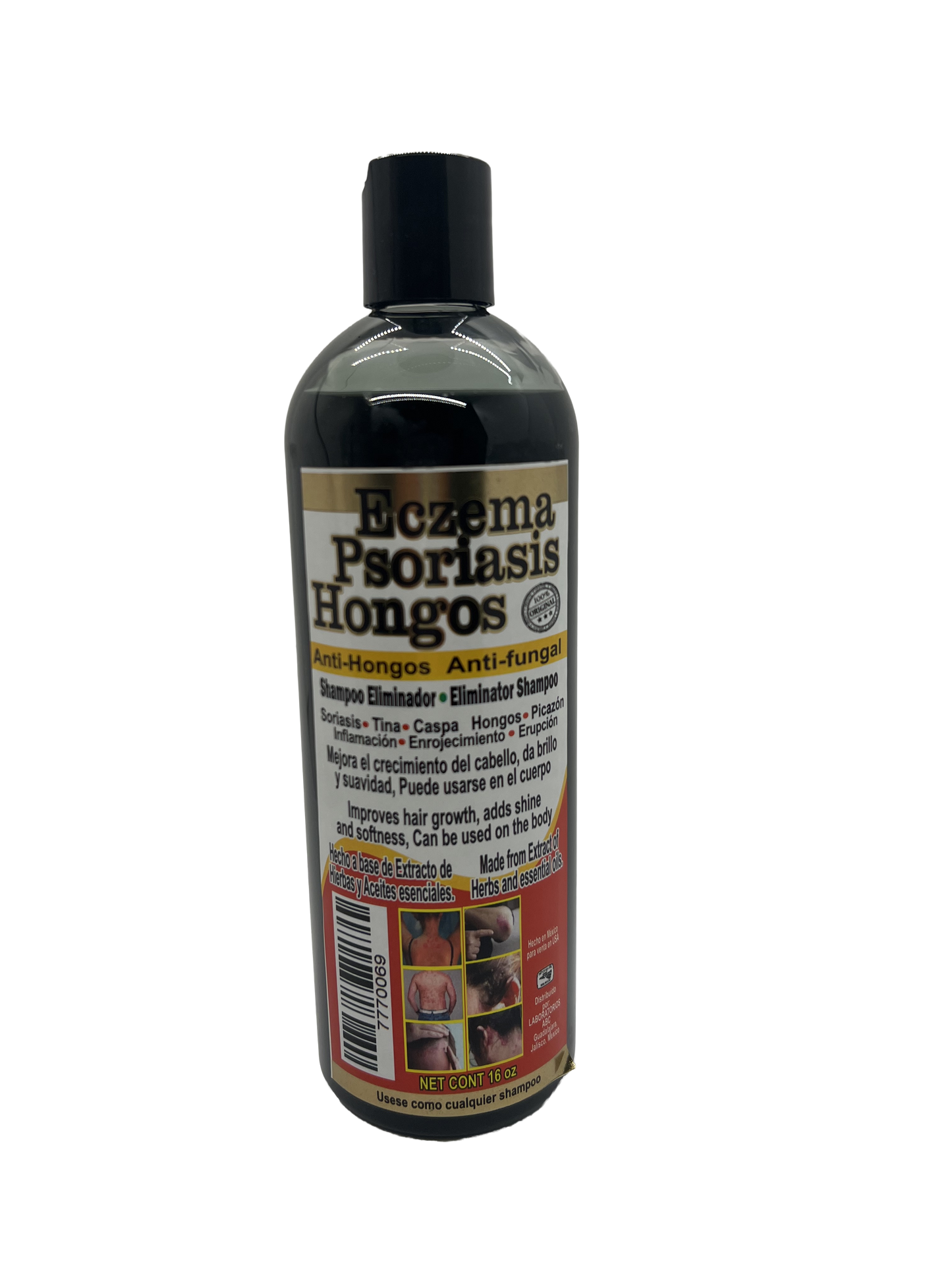 Eczema Shampoo Psoriasis, y Hongos 32oz